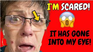 Shingles, MS, and What Happened to My Eyes!