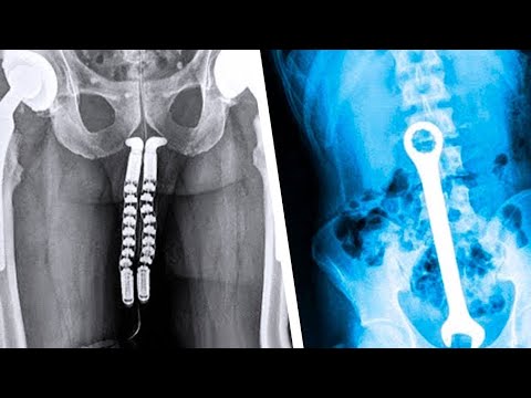 عجیب و غریب ترین چیز هایی که توسط دستگاه ایکس ری کشف شدند