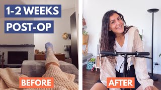 Achilles Tendon Rupture | 1-2 WEEKS post op, managing pain, showering, and the knee scooter – Part 5