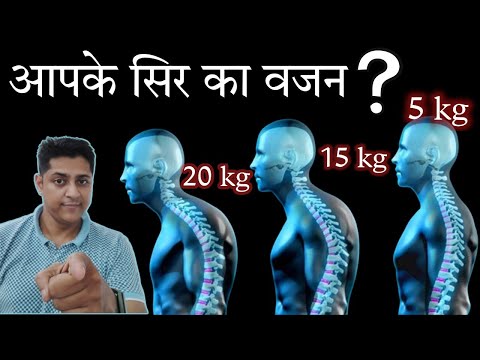 मोबाइल के इस्तेमाल से गर्दन की समस्या कैसे होती है?Side Effects of mobile phone#textneck#neckposture