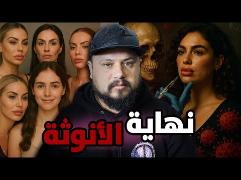 قصة صادمة امراة ذاب ليها وجهها بسبب الفيلر🚨هذا ما يفعله الفيلر في النساء!