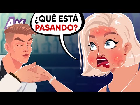 Mi Cara Se Hinchó El Doble Por El Beso De Mi Prometido