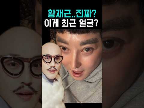 디자이너 황재근, 최근 얼굴 충격 변화