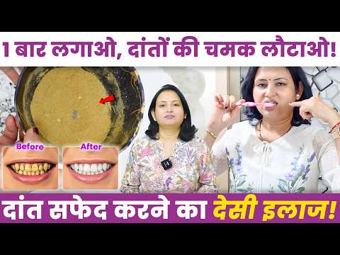 बिना केमिकल के दांतों की सफाई – बनाएं ये देसी मंजन