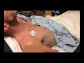 Understanding Neck Pain Assessment