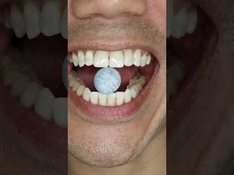 โSuper Sourโ Nobel Super Soda Candy ASMR #shorts #asmr