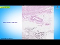 Blood Vessel Structure and Function