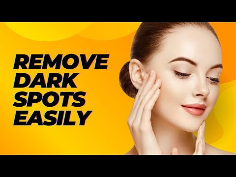 Dark Spot हटाने और Glowing Skin पाने का तरीका, Dark Spots kaise remove kare, Get Clear Glowing Skin