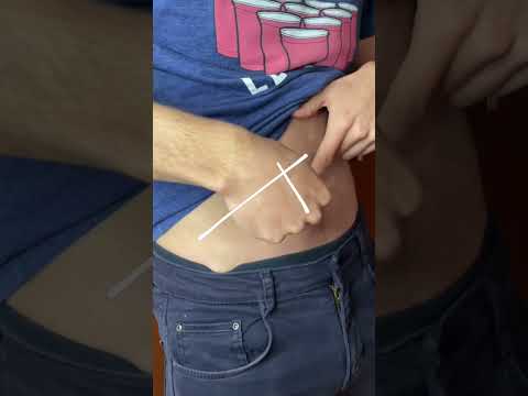 Como saber si alguien tiene apendicitis #shorts #aprende