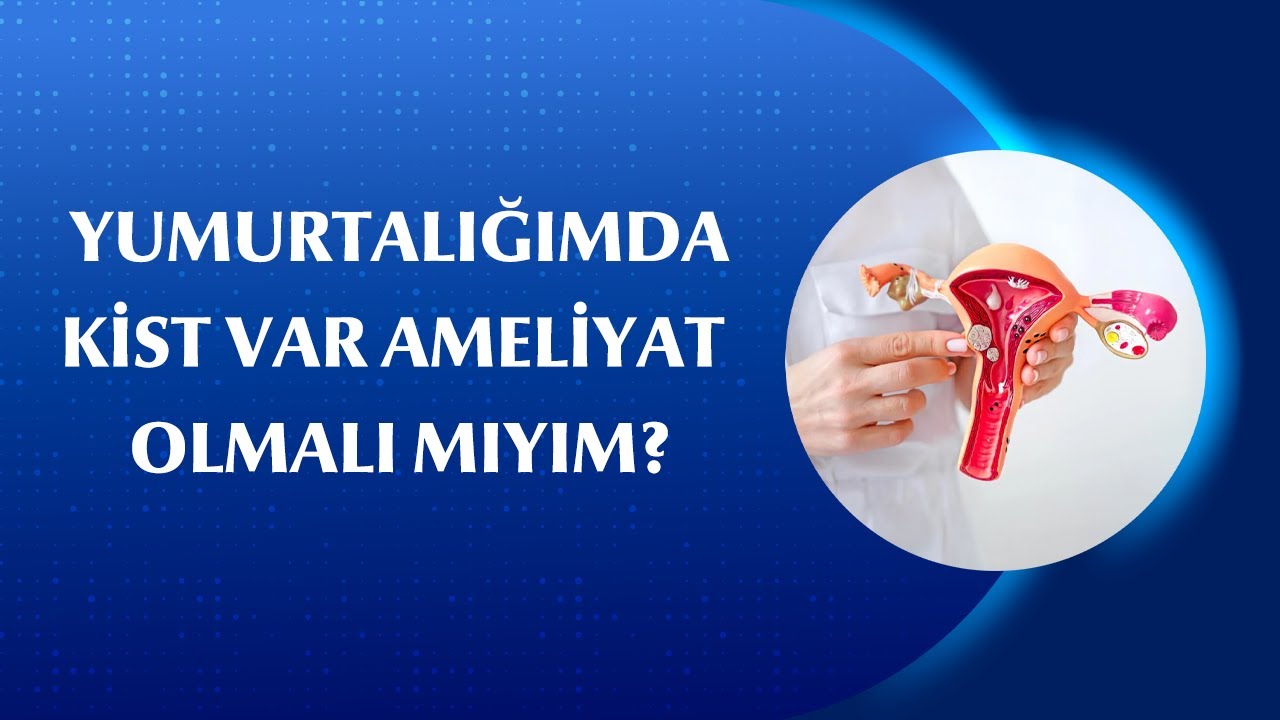 Yumurtalık Kisti Her Zaman Ameliyat Gerektirir mi?