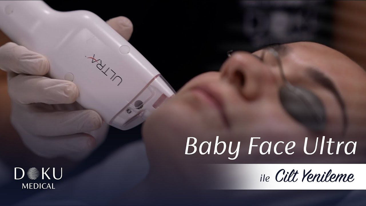 #Thuliumlaser – Baby Face Ultra \ Bebeksi bir cilt için!