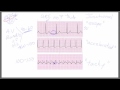 Junctional Rhythms in Cardiac Conduction