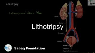 Lithotripsy