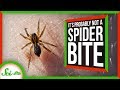 Understanding Spider Bites