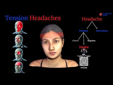 Tension Headache, the most common physical complaint. Causes, how it happens, how to treat it.