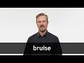 Understanding Bruises