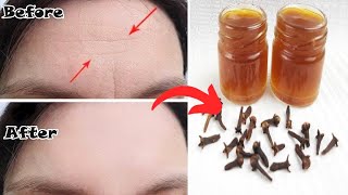 اخلطي القرنفل مع الماء  لتبدين أصغر من سنك ب10 سنوات! بوتوكس طبيعي! بالقرنفل لن تصدقي النتيجة