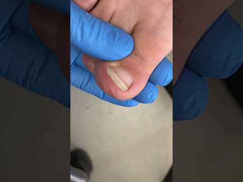Satisfying pedicure video!  #shorts #manicuresvideos #pedicure #ASMR