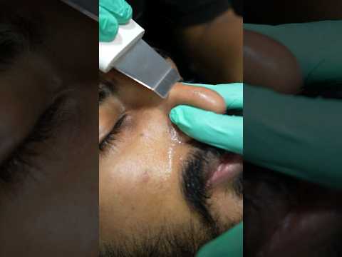 Hydra Facial വളരെയധികം വില കുറവിൽ ചെയ്യുന്ന സ്ഥലം ആണ് Femstyle | #shorts #youtubeshorts #hydrafacial