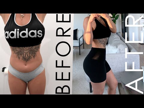 I got a Brazilian butt lift in Mexico... here's what happened