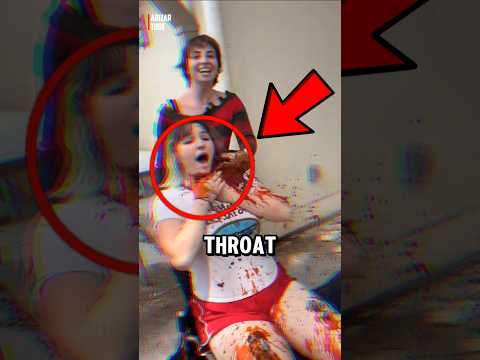 OMG ‼️ This woman's neck was cut, apparently....😱