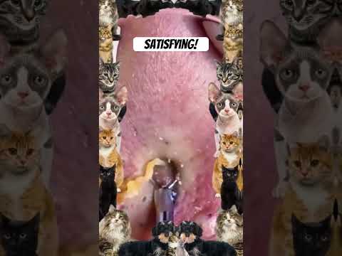 Wow! #pimple #pimplepopping #pimples #shortsfeed #shortvideo #shorts #short #youtube #youtubeshorts