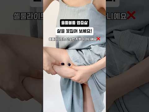 ✅지금 바로 살을 꼬집어 보세요‼️👉🏻살을 꼬집었을 때 울퉁불퉁 & 알갱이가 만져진다 → 염증성 지방👉🏻말랑하고 늘어난다 → 일반 지방💡