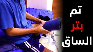 شاب بعمر الزهور تم بتر ساقة وأصبح بلا امل بلا حلم بلا أهداف بلا طموح 