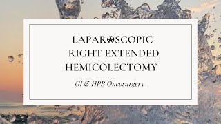 Laparoscopic Right extended hemicolectomy
