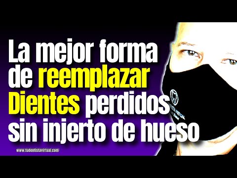 IMPLANTES DENTALES SIN CIRUGÍA Y SIN HUESO?