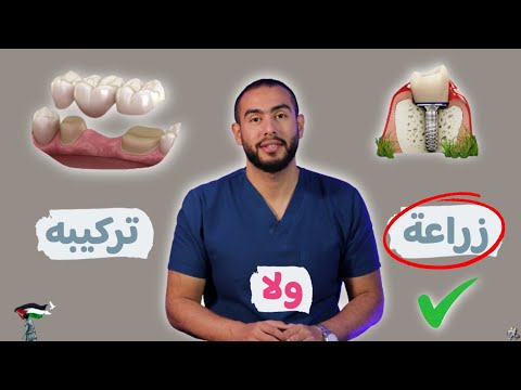 تعمل زراعة لأسنانك ولا تركيبة ثابته ايهما افضل | عيوب زراعة الاسنان | تكلفة زراعة الاسنان