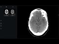 CNS Viva Cases 3 (P1)