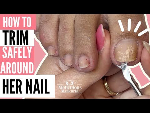 How to Trim Nails Safely and Corn Reduction Pedicure Tutoriall