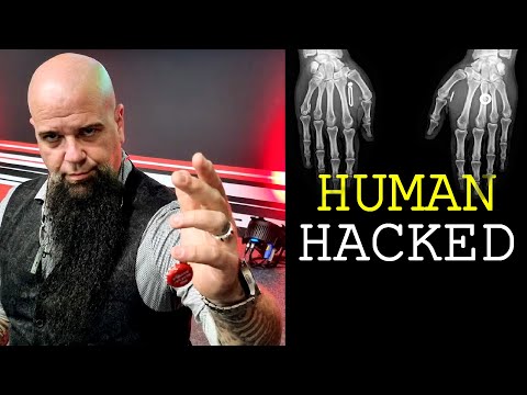 The Hacker with Hardware Implants (interview)