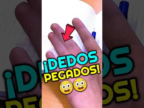 ¡DEDOS PEGADOS! 😱
