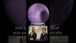 WE ARE BACK! Ear Wax Removal Plug