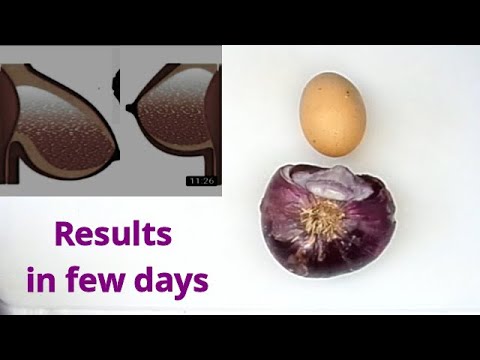 Use egg and onion tighten and firm BR it will stand again