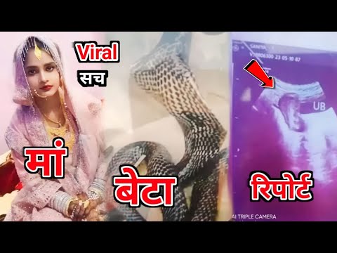 महिला के पेट से कोबरा सांप के बच्चे ने लिया जन्म का भंडाफोड़