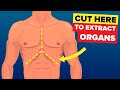 Organ Donation and Transplantation Concepts