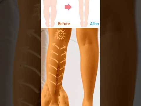 Calf muscles massage techniques #calfmassage #calfmuscles #calfpain #legmassage