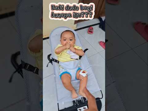 Kaki dede bayi kenapa itu❓️ #trendingshorts