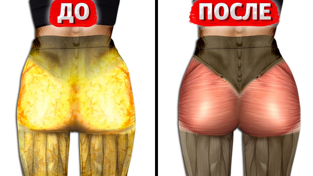 Как убрать жир с ягодиц и ляжек за 10 минут? Очень просто, действуй!