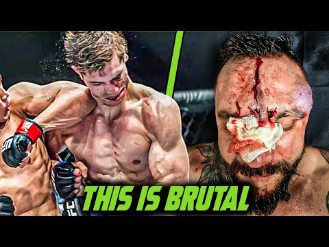 Elbows That Broke Faces 😳