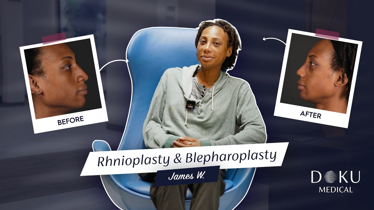 Rhinoplasty (Nose surgery)