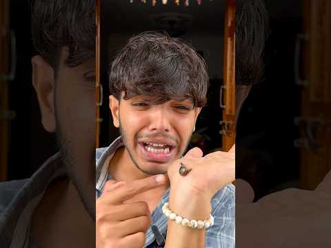 यह कीड़ा मेरे हाथ पर चिपक गया