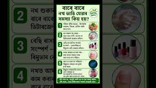 বাৰে বাৰে নখ ভাঙি যোৱাৰ সমস্যা কিয় হয় #nails #nailart #healthylifestyle #healthtips #funnails #viral