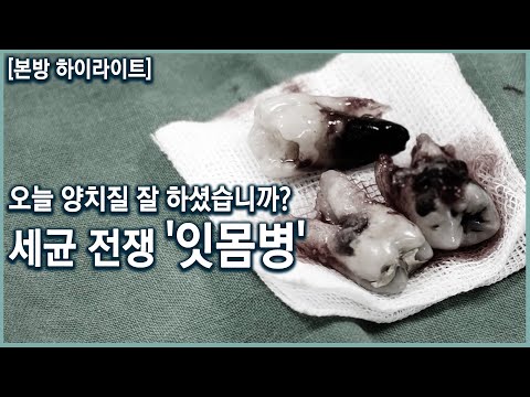 방치하면 잇몸뼈까지 녹인다. 온 몸의 건강을 위협하는 잇몸병! 잇몸병 개선 프로젝트 (KBS_2018.11.14)