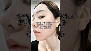 제가 애기놓고 제일 좋아하는 시술🤍바로 리쥬란이예요!