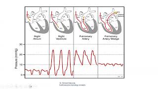 Invasive hemodynamics, Dr Hatim kheirallah, 4/3/2026.