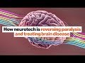 Innovations in Brain-Computer Interfaces